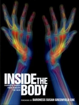 Image of Inside the Body by Windsor Chorlton and Science Photo Library Hardback