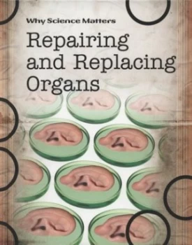 Image of Repairing and Replacing Organs by Andrew Solway Hardback