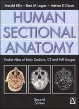 Image of Human Sectional Anatomy by Adrian Dixon Book