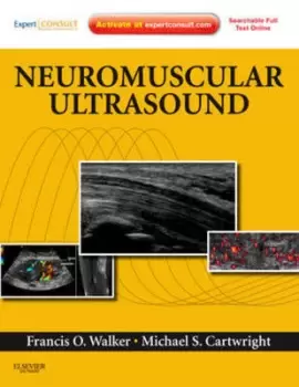 Image of Neuromuscular ultrasound by Francis O Walker