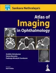 Image of Atlas of Imaging in Ophthalmology