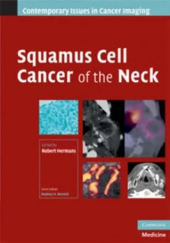Image of Squamous Cell Cancer of the Neck by Robert Hermans Hardback