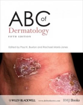 Image of Abc of Dermatology by Paul K. Buxton Paperback