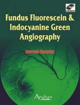 Image of Fundus Fluorescein and Indocyanine Green Angiography by Amresh Chopdar Hardback