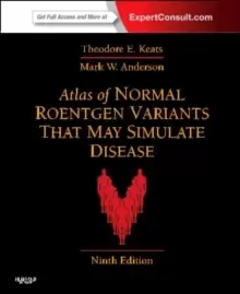 Image of Atlas of Normal Roentgen Variants That May Simulate Disease : Expert Consult - Enhanced Online Features and Print