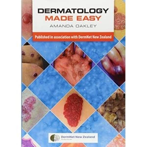 Image of Dermatology Made Easy by Amanda Oakley (Paperback, 2017)