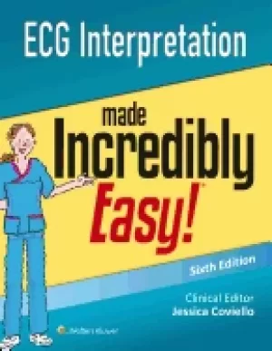 Image of ecg interpretation made incredibly easy