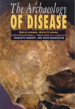 Image of The Archaeology of Disease by Charlotte a Roberts and Keith Manchester Paperback