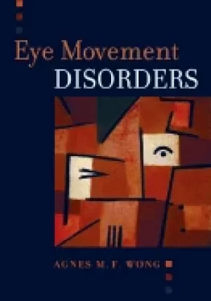 Image of eye movement disorders