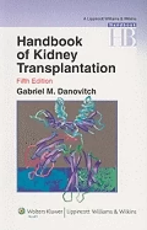 Image of handbook of kidney transplantation