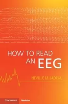 Image of How to Read an EEG
