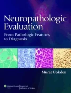 Image of neuropathologic evaluation from pathologic features to diagnosis