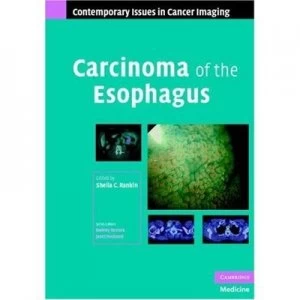 Image of Carcinoma of the Esophagus by Sheila C. Rankin Hardback