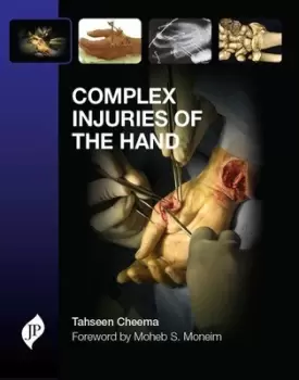 Image of Complex Injuries of the Hand
