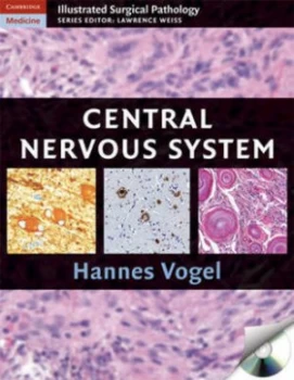 Image of Nervous System by Hannes Vogel Hardback
