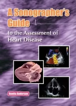 Image of A Sonographers Guide to the Assessment of Heart by Bonita Anderson