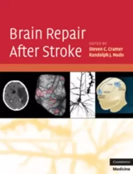 Image of Brain repair after stroke by Steven C Cramer