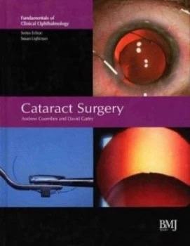 Image of Cataract Surgery by Andrew Coombes Hardback