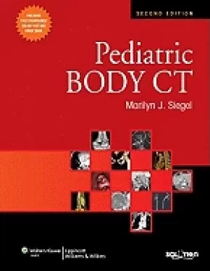 Image of pediatric body ct