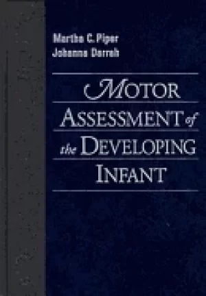 Image of motor assessment of the developing infant