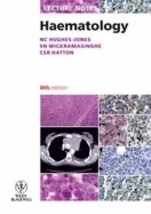 Image of lecture notes haematology
