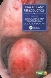 Image of Fibroids and Reproduction