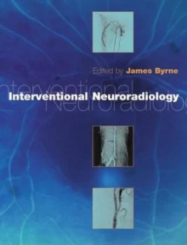 Image of Interventional Neuroradiology by J. V Byrne Book