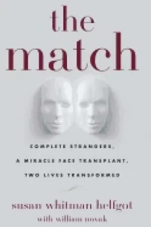 Image of match complete strangers a miracle face transplant two lives transformed