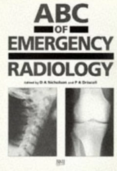 Image of Abc of Emergency Radiology by David A. Nicholson Paperback