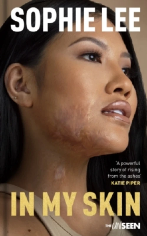 Image of In My Skin. Hardback. By Sophie Lee Books
