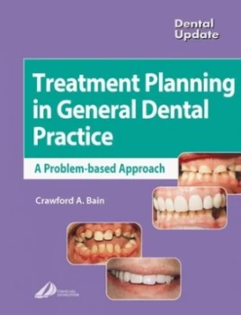 Image of Treatment Planning in General Dental Practice by Crawford Bain Paperback