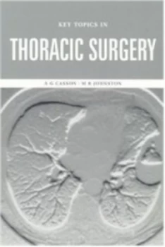 Image of Key Topics in Thoracic Surgery by Ag Casson Paperback