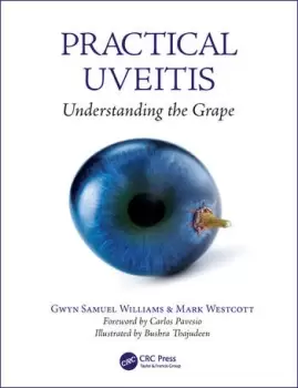 Image of Practical UveitisUnderstanding the Grape
