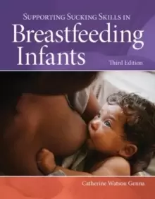 Image of Supporting Sucking Skills In Breastfeeding Infants