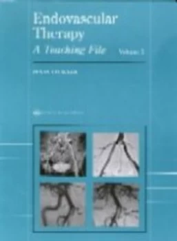 Image of Endovascular Therapy by Renan Uflacker Hardback