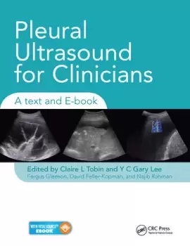 Image of Pleural Ultrasound for CliniciansA Text and E-book