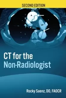 Image of CT for the Non-Radiologist : The Essential CT Study Guide
