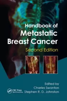 Image of Handbook of Metastatic Breast Cancer