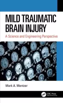 Image of Mild Traumatic Brain InjuryA Science and Engineering Perspective