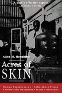 Image of acres of skin human experiments at holmesburg prison