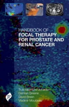 Image of Handbook of focal therapy for prostate and renal cancer by Truls E. Bjerklund Johansen