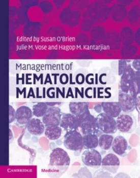 Image of Management of Hematologic Malignancies by Susan Obrien Hardback