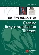 Image of nuts and bolts of cardiac resynchronization therapy