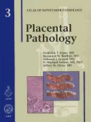 Image of placental pathology