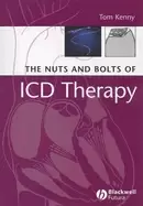 Image of nuts and bolts of icd therapy