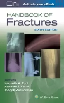 Image of Handbook of Fractures