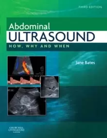 Image of Abdominal Ultrasound : How, Why and When