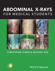 Image of Abdominal X-rays for Medical Students
