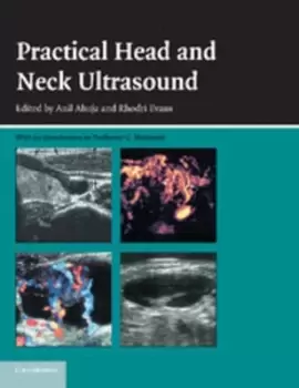 Image of Practical head & neck ultrasound - Anil T Ahuja - Paperback - Used
