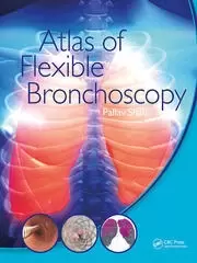 Image of Atlas of Flexible Bronchoscopy